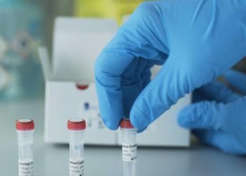 ഇടുക്കി ജില്ലയ്ക്കിന്ന് നിർണായക ദിവസം : ഫലം കാത്ത് 300 ടെസ്റ്റുകൾ