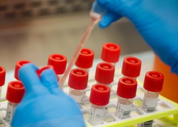 കോവിഡ്-19 രോഗബാധ : ദുബായിൽ ഒരു മലയാളി കൂടി മരിച്ചു