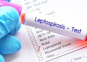 എലിപ്പനി : കോഴിക്കോട് ജില്ലയിൽ ആരോഗ്യ പ്രവർത്തക മരണപ്പെട്ടു