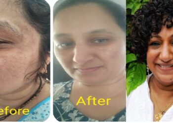 തന്റെ കസ്റ്റമറിന് പിഗ്‌മിന്റേഷൻ മാറ്റിയെന്ന അവകാശവാദവുമായി ഫിൽറ്റർ ഫോട്ടോയുമായി ബ്യൂട്ടീഷൻ അംബികാ പിള്ള : കണ്ടം വഴി ഓടിച്ചു സോഷ്യൽ മീഡിയ
