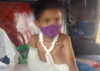 വീണു പരുക്കേറ്റ ആദിവാസി ബാലന് കൈ മാറി പ്ലാസ്റ്റര് ഇട്ട് ഡോക്ടര്; ഗുരുതര വീഴ്ച