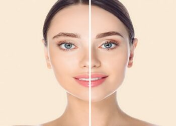 കണ്ണുകൾക്ക് താഴെ കറുത്തപാടുകളുണ്ടോ ? ഇതാ വീട്ടിൽ പ്രയോഗിക്കാവുന്ന ചില പൊടിക്കൈകൾ, ഒരാഴ്ചക്കുള്ളിൽ തന്നെ വ്യത്യാസം അറിയാം