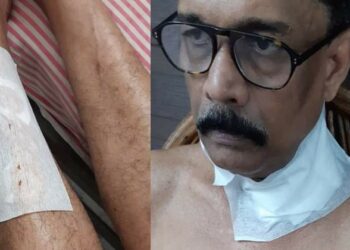 തോരണത്തിന് പിന്നാലെ റോഡിലേക്ക് താഴ്ന്ന കേബിളും യാത്രക്കാർക്ക് ഭീഷണി; കൊച്ചിയിൽ കേബിൾ കഴുത്തിൽ കുരുങ്ങി ഇരുചക്ര വാഹനയാത്രികന് പരിക്ക്