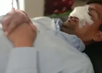 ചൈനീസ് മാഞ്ച മുഖത്ത് തട്ടി; ബിജെപി നേതാവിന്റെ മൂക്കും ചുണ്ടും മുറിഞ്ഞു