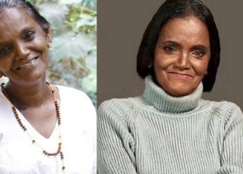 ആരോഗ്യനില ഗുരുതരം; മോളി കണ്ണമാലിയെ കൊച്ചിയിലെ സൂപ്പർ സ്‌പെഷ്യാലിറ്റി ആശുപത്രിയിലേക്ക് മാറ്റി