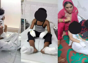 മദ്രസയിലെ വൈദ്യുതി മീറ്റർ പൊട്ടിത്തെറിച്ചു; നാല് കുട്ടികൾക്ക് പൊള്ളലേറ്റു