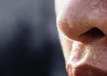 അമിതമായ വിയർപ്പുണ്ടോ, എങ്കിൽ അത് ഈ രോഗത്തിൻറെ ലക്ഷണമാണ്