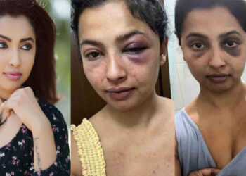 വായും മൂക്കൂം പൊത്തി ക്രൂരമായി മർദ്ദിച്ചു; ഷൂട്ടിംഗിന് പോകാതിരിക്കാൻ ഫോൺ എറിഞ്ഞുടച്ചു; മുൻ കാമുകനെതിരെ നടി