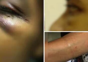 നടുറോഡിൽ യുവതിക്ക് നേരെ അതിക്രമം; വിവരം അറിയിച്ചിട്ടും തിരിഞ്ഞ് നോക്കാതെ പോലീസ്; കേസെടുത്തത് മൂന്ന് ദിവസത്തിന് ശേഷം