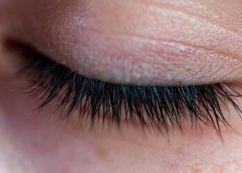 കണ്ണ് വീക്കം, ചൊറിച്ചിൽ എന്നിവയ്ക്ക് ചികിത്സ തേടിയെത്തി: സ്ത്രീയുടെ കണ്ണിൽ നിന്ന്  നീക്കം ചെയ്തത് 15 സെന്റിമീറ്ററോളം നീളമുള്ള വിര