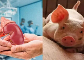 മനുഷ്യനിൽ പന്നിയുടെ വൃക്ക മാറ്റി വച്ച് ശസ്ത്രക്രിയ; പരീക്ഷണം വിജയകരമെന്ന് ഡോക്ടർമാർ