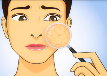 ചർമം വരണ്ടു പോകുന്നുണ്ടോ ; നിസ്സാരമായി കാണരുത്;  കാരണം മനസ്സിലാക്കി പരിഹാരം ചെയ്യാം