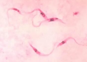 നിസാരമല്ല, ലോകത്ത് 70 ലക്ഷം ആളുകളെ ബാധിക്കുന്ന അണുബാധ; ചഗാസ് രോഗം പടരുന്നത് എങ്ങനെ?