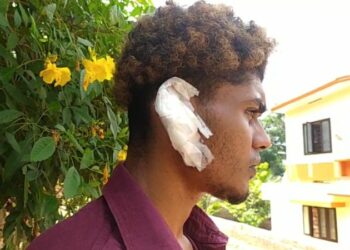 യുവാവിനെ ആക്രമിച്ച് ചെവി കടിച്ചു പറിച്ചതായി പരാതി