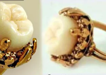 30 ലക്ഷം രൂപയുള്ള പല്ല്; ലോകത്തിലെ ഏറ്റവും വില കൂടിയ പല്ല് ഒരു ബുദ്ധിരാക്ഷസന്റേത്