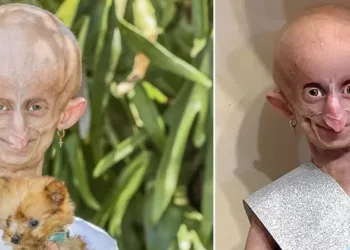 ബാല്യത്തിൽ തന്നെ വൃദ്ധയായി ; 19-ാം വയസിൽ വിടവാങ്ങി ബിയാന്ദ്രി ബൂയ്സെൻ