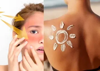 ഒരുമിനിറ്റ് വെയിൽ ഏൽക്കാതെ തന്നെ ശരീരം ഇരുണ്ടുപോകുന്നുവോ?: കുടലിന്റെ അനാരോഗ്യവും കാരണമായേക്കാം