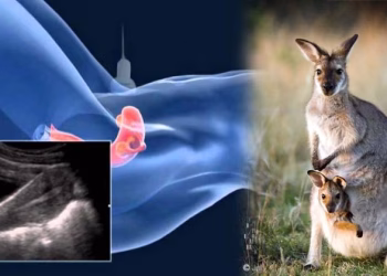 ഐവിഎഫിലൂടെ കംഗാരു ഭ്രൂണങ്ങൾ സൃഷ്ടിച്ചു; ചരിത്രനേട്ടവുമായി ഓസ്ട്രേലിയൻ ശാസ്ത്രഞ്ജർ