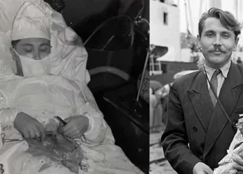 കണ്ണാടിയിലെ പ്രതിബിംബം നോക്കി രാത്രിയിൽ സ്വന്തം അപ്പൻഡിക്‌സിന്റെ ബേസിൽ തുന്നലിട്ടു,മനുഷ്യൻ അത്ഭുതമാണ്; കുറിപ്പ് വൈറലാവുന്നു