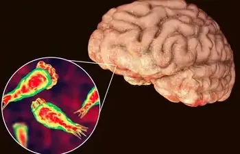 സംസ്ഥാനത്ത് വീണ്ടും അമീബിക് മസ്തിഷ്കജ്വരം ; ചികിത്സയിലുള്ളത് എട്ടുപേർ