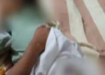 നിക്കറിൽ മൂത്രം ഒഴിച്ചു,നാലര വയസുകാരനെ ചട്ടുകം കൊണ്ട് പൊള്ളിച്ചു; അമ്മ അറസ്റ്റിൽ