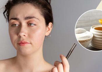 മുഖത്തെ രോമങ്ങൾ ആത്മവിശ്വാസം കുറയ്ക്കുന്നുവോ..?വീട്ടിലുണ്ട് 5 പരിഹാരങ്ങൾ