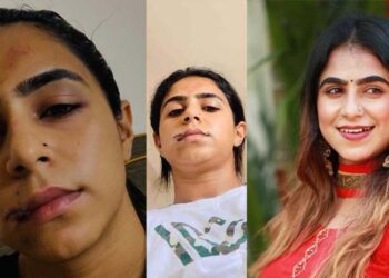 മേൽചുണ്ട് മുറിഞ്ഞുപോയി,വയറ്റിൽ ചവിട്ടി,കടിച്ചു:സിമ്പതിയ്ക്ക് വേണ്ടിയല്ല ഇതൊക്കെ പറയുന്നത്: മുൻ പങ്കാളിക്കെതിരെ നടി ജസീല