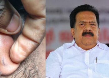 വ്യാജ പരാതിയിൽ ഹൃദ്രോഗിയായ യുവാവിന് ക്രൂരമർദ്ദനം; കൂടൽ പൊലീസിനെതിരെ ആഭ്യന്തരമന്ത്രിക്ക് പരാതി