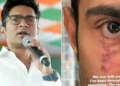 ‘മുഖത്തെ പാട് ഞാൻ കടന്നുപോയ വഴികളാണ് പറയുന്നത്, പോരാട്ടം തീർന്നിട്ടില്ല!’; ഇൻസ്റ്റഗ്രാം പോസ്റ്റുമായി അഭിഷേക് ബാനർജി!